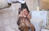 خارج کردن جنینی از بدن پسر 22ساله کرمانی/ عکس 18+