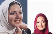 قبل و بعد عمل زیبایی بازیگران ایرانی