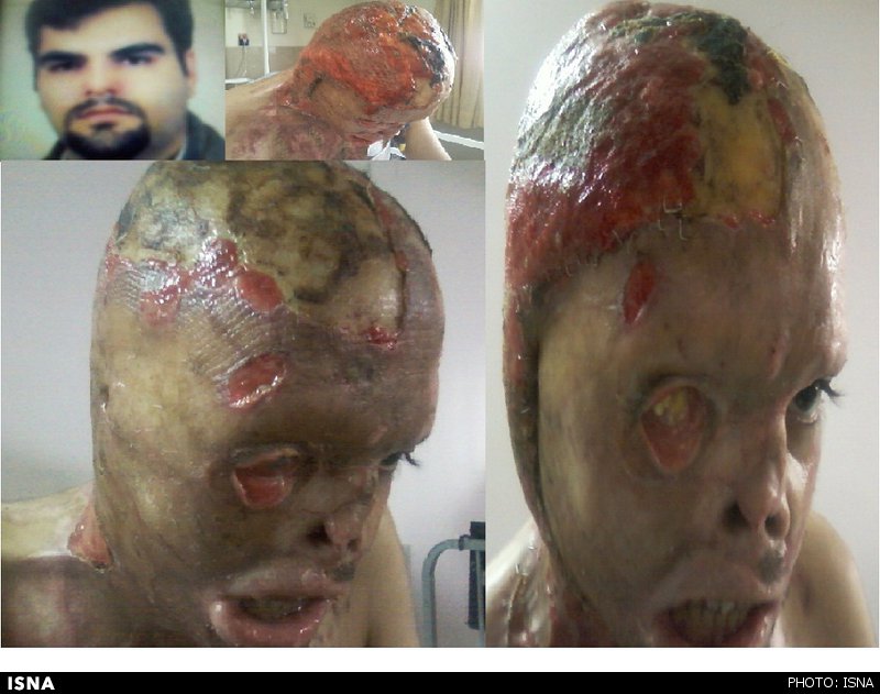 اسید پاشی اشتباهی نظافتچی به کارمند / عکس (+16)