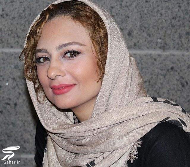 عکسهای جدید یکتا ناصر قبل و  بعد عمل بینی (کلیک کنید)