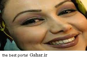 بهنوش بختیاری تغییر چهره داد / عکس