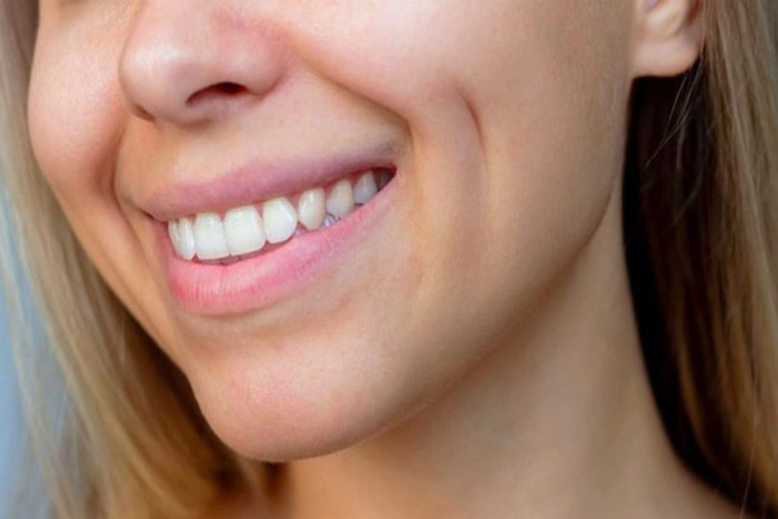 چال خنده چیست؟/جراحی چال خنده چگونه است؟