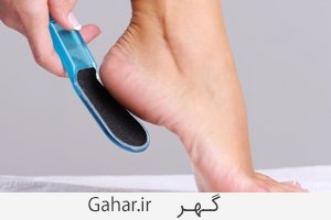 علل میخچه و پینه پا + راه های درمان