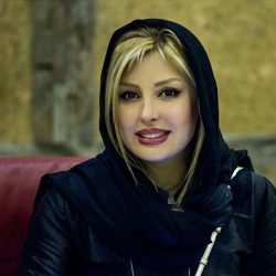 صحبت های ناگفته نیوشا ضیغمی در مورد جراحی بینی اش!