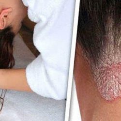 عوارض خطرناک خوابیدن با موهای نم دار