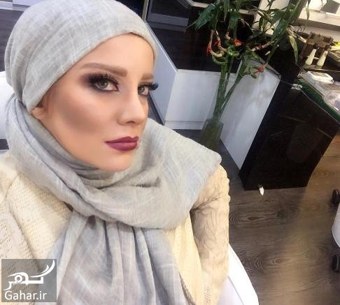عکس جدید شراره رخام بعد از تخلیه پروتز لب