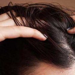 این اشتباهات باعث چرب شدن مو می شوند