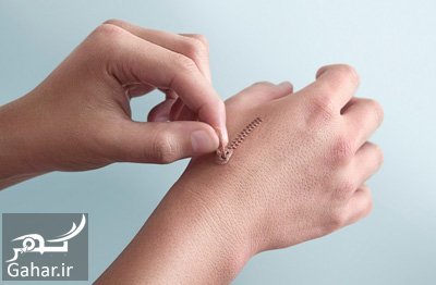 ارتباط مستقیم نوع تغذیه با ترمیم زخم