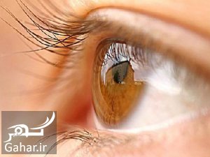 علل و علایم و درمان آستیگماتیسم