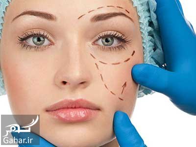 نکاتی در مورد آبسه و عفونت بعد از پروتز گونه