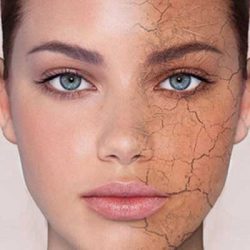 روش های طبیعی و سالم برای درمان خشکی پوست صورت