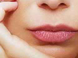 روش های درمان طبیعی برای لب خشک و ترک خورده