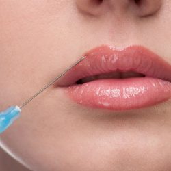 هزینه پروتز لب چقدر است؟
