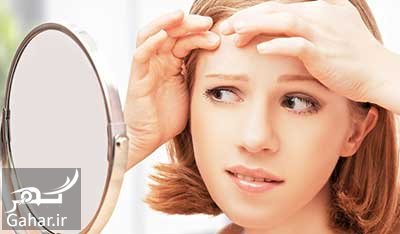 از بین بردن آکنه با این ترفندها