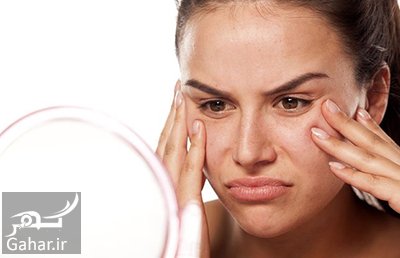 همه چیز در مورد افتادگی پوست