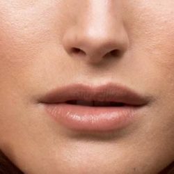 راهکارهای بستن منافذ پوست + علل باز شدن