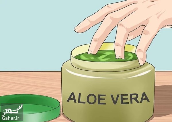 درمان هموروئید خارجی