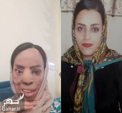 اسید پاشی روی صورت خواهر شوهر جنایت عروس با لباس سربازی!
