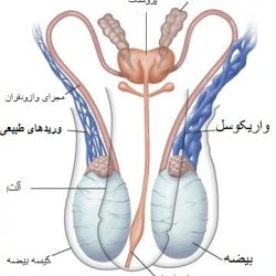 هزینه عمل واریکوسل (با بیمه و آزاد)