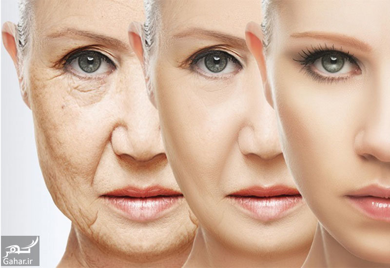 از بین بردن چین و چروک صورت با روش های خانگی
