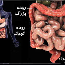درمان تنبلی روده + علت تنبل شدن روده چیست؟