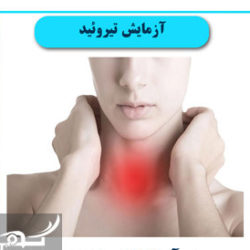 هزینه آزمایش تیروئید