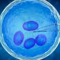 هزینه آی وی اف در سال ۱۴۰۱ ivf