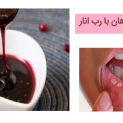درمان آفت دهان با رب انار