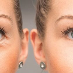 بهترین کرم برای چروک دور چشم کدام است؟