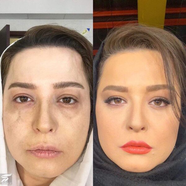 عکس مهراوه شریفی نیا قبل و بعد از خودکشی!