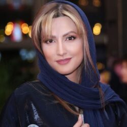 تغییر چهره سمیرا حسینی بعد از عمل بینی / تصاویر