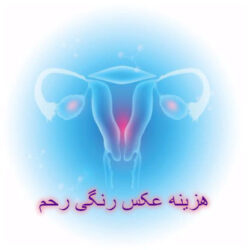 هزینه عکس رنگی از رحم در سال ۱۴۰۳