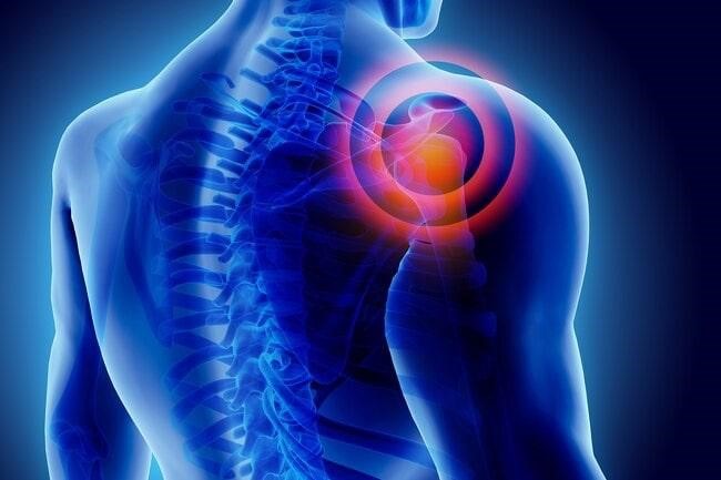 خداحافظی با درد شانه و کتف در کلینیک تخصصی و فوق تخصصی ارتوپدی دکتر میر