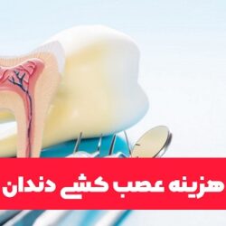 هزینه عصب کشی دندان ۱۴۰۱