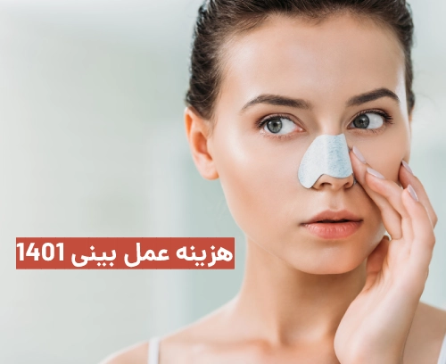 هزینه عمل بینی ۱۴۰۱