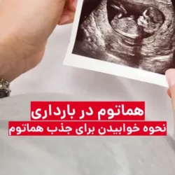 نحوه خوابیدن برای جذب هماتوم