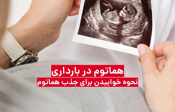 نحوه خوابیدن برای جذب هماتوم