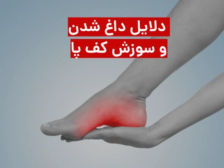 داغ شدن و سوزش کف پا نشانه چیست