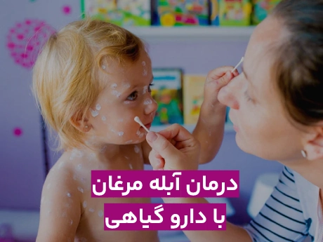 دارو گیاهی برای آبله مرغان