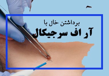 صفر تا صد آر اف سرجیکال: آر اف سرجیکال و کاربردهای آن