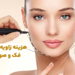 هزینه زاویه سازی صورت و فک سال ۱۴۰۳