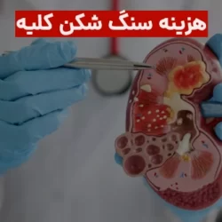 هزینه سنگ شکن کلیه 1403