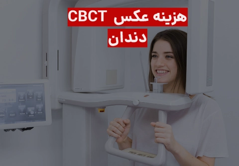 هزینه عکس cbct دندان