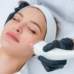 هزینه لیزر جای جوش در سال ۱۴۰۲ چقدر است؟