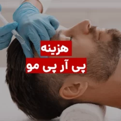 هزینه پی آر پی مو + روش PRP چیست