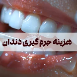 هزینه جرم گیری دندان ۱۴۰۵ + هزینه با بیمه و مزایای جرمگیری دندان