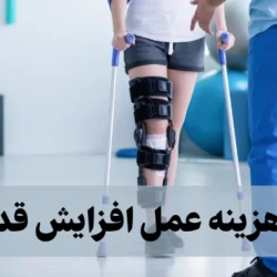 هزینه عمل افزایش قد + [جزییات کامل انواع عمل افزایش قد]