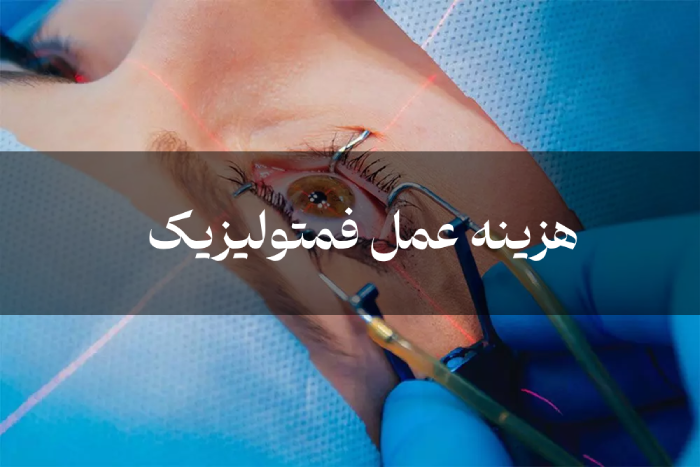 هزینه عمل فمتولیزیک [هزینه عمل جراحی چشم با لیزر]