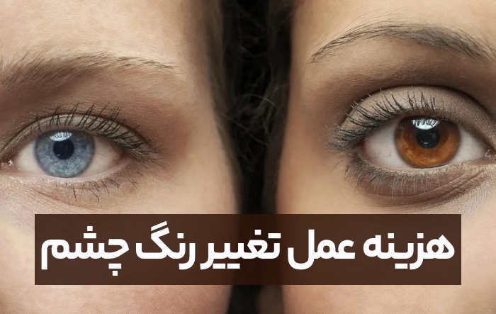 هزینه عمل تغییر رنگ چشم + دوران نقاهت و عوارض