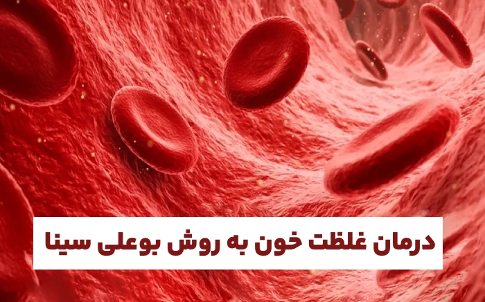 درمان غلظت خون به روش بوعلی سینا (درمان غلظت خون سنتی)